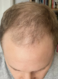 Case 1 thumbnail