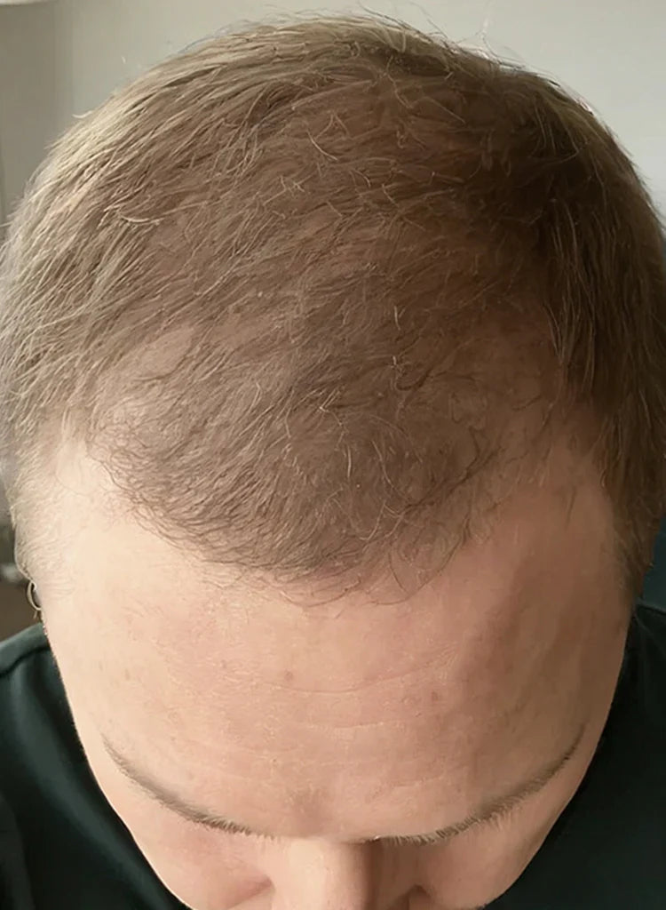 After