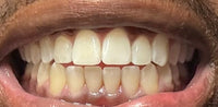 Case 3 thumbnail