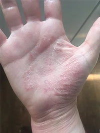 Case 1 thumbnail