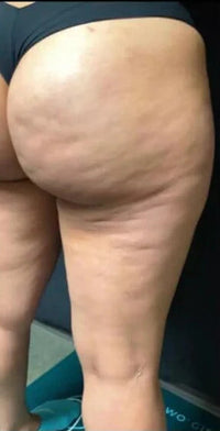 Case 1 thumbnail