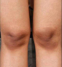 Case 3 thumbnail